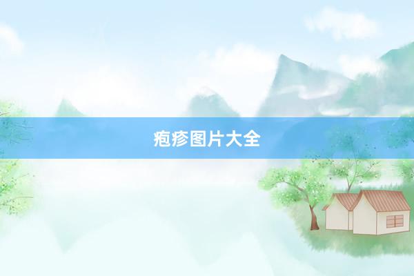 疱疹图片大全